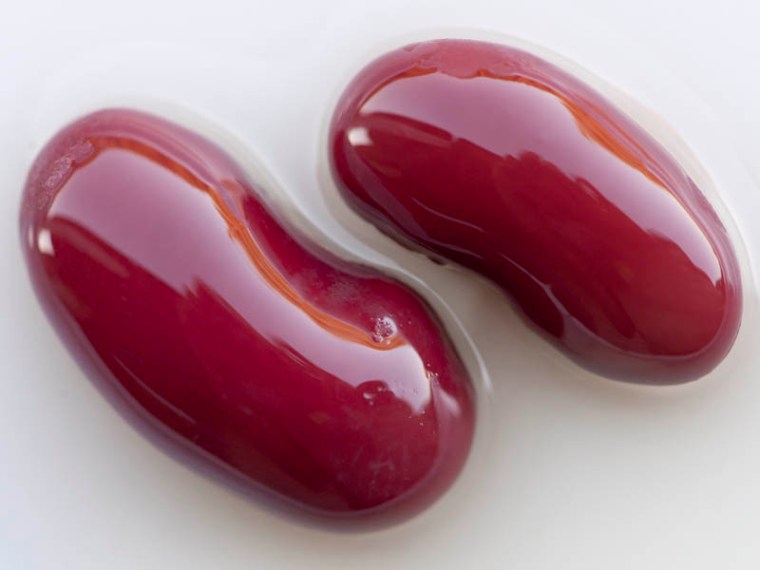 Kidney beans, like most legumes, are super foods when it comes to controlling blood sugar and preventing diabetes. People with diabetes are more likely to develop kidney damage. So, interestingly, kidney beans are actually good for kidney health!(© All Rights Reserved)