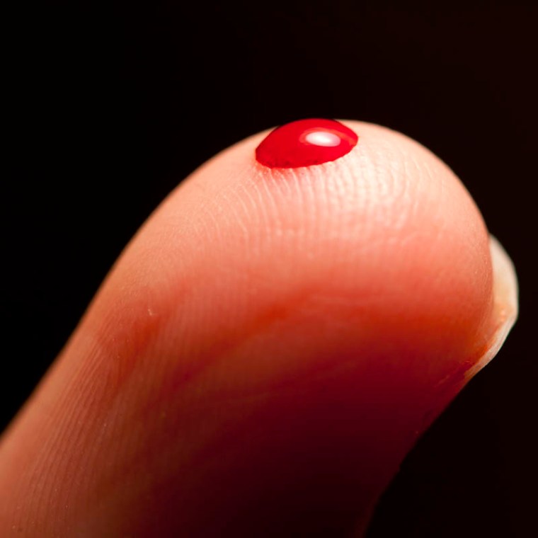 Everybody bleeds, but while this is may be a minor issue for most of us, it can be a matter of life and death for those suffering from haemophilia. (© All Rights Reserved)